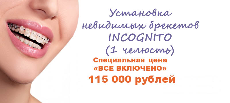 incognito