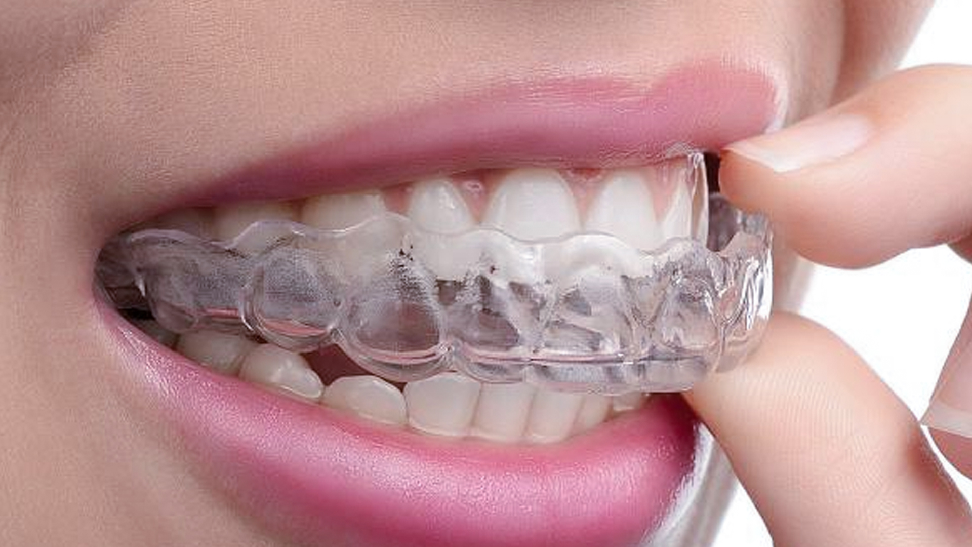 Ночной скрежет зубами как стоматологическая проблема