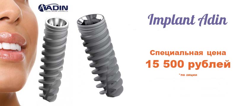 Стоимость установки зубного импланта Adin  - 15 500 руб. ( по акции )