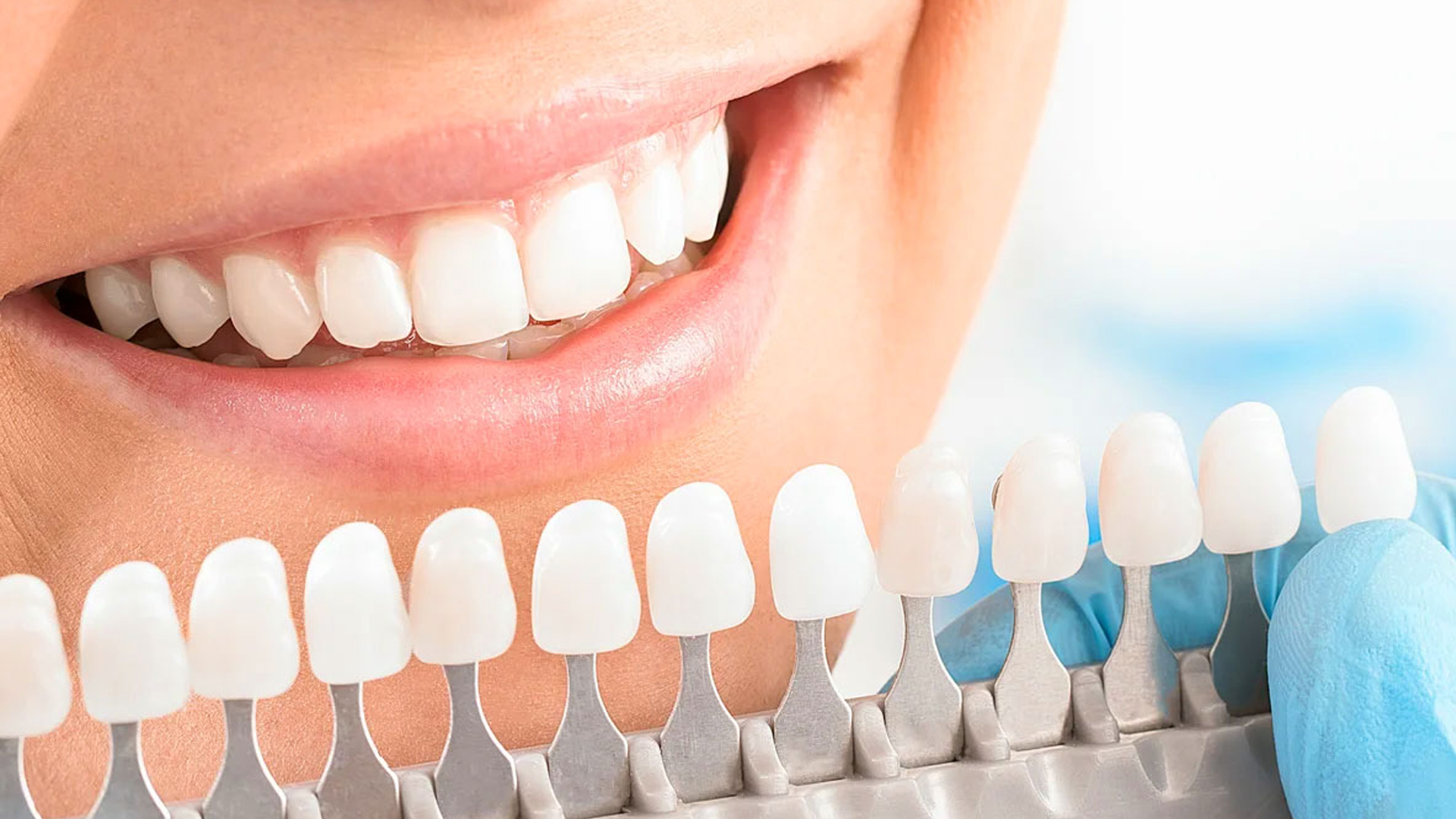 otbelivanie zubov amazing white premium 02