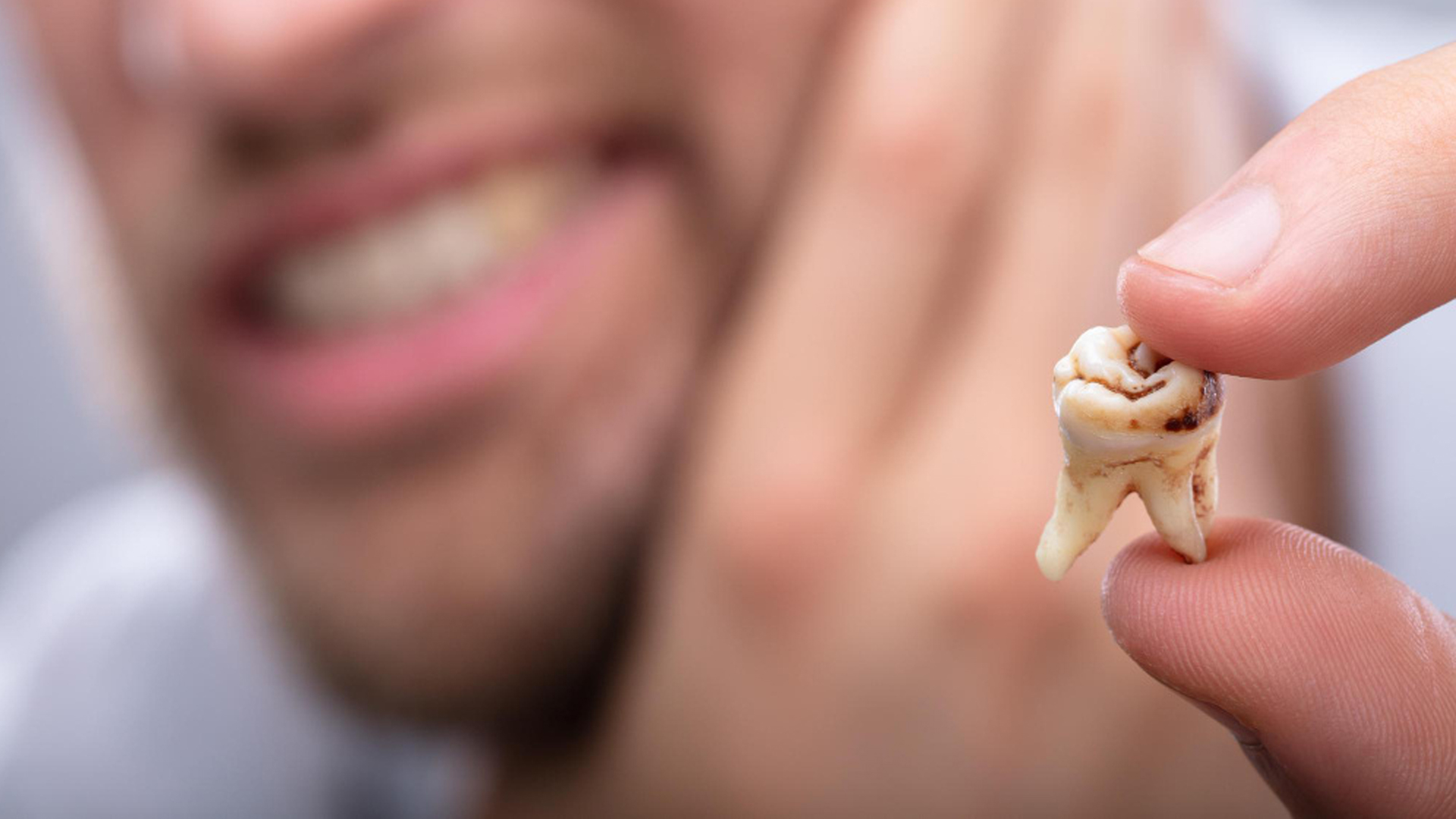 stiraemost zubov kak ostanovit proczess 01