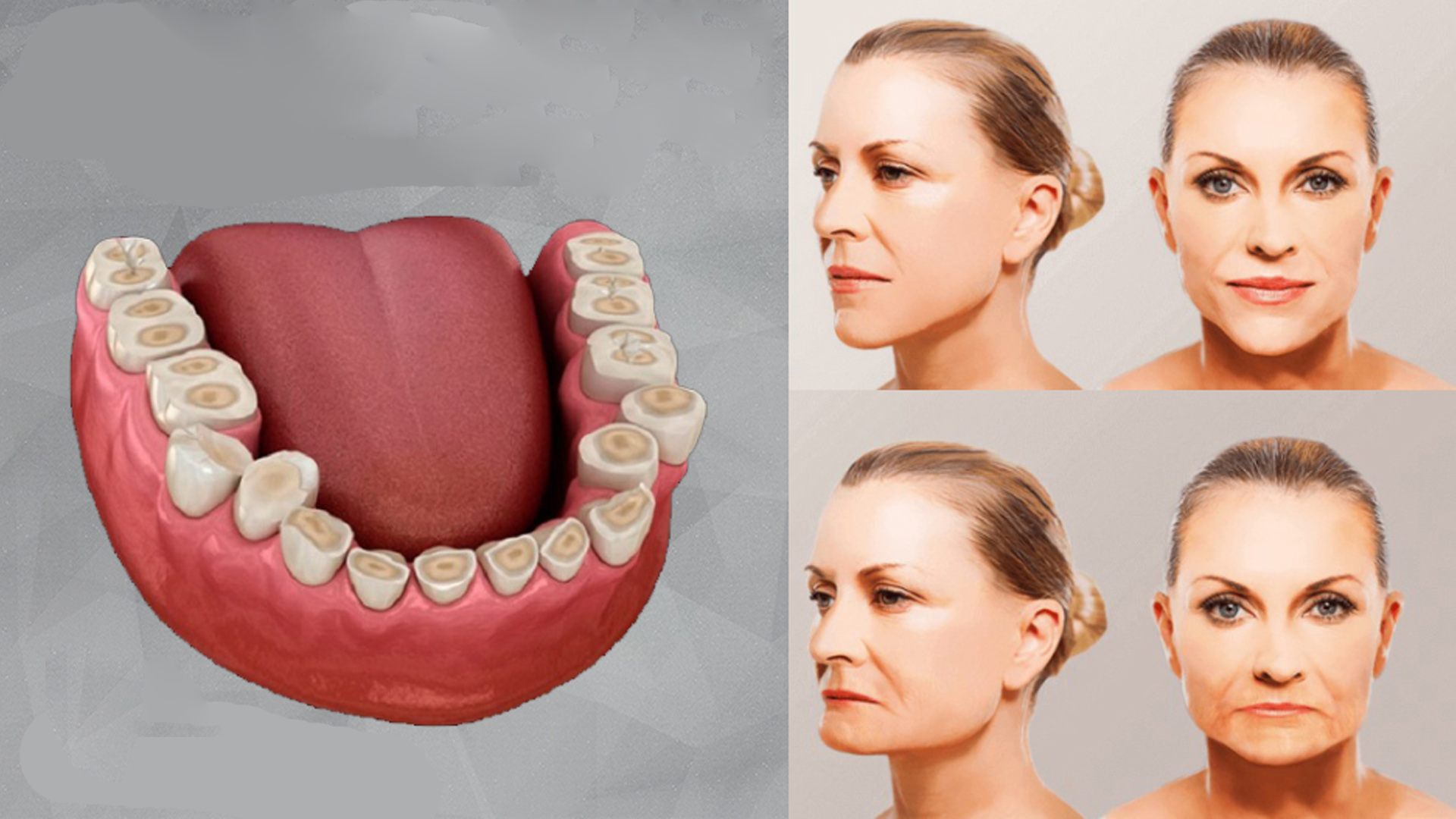 stiraemost zubov kak ostanovit proczess 02