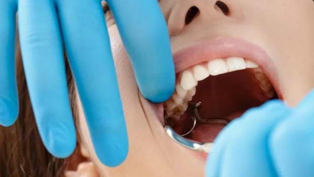 procedura udaleniya zuba bolno ili strashno 2