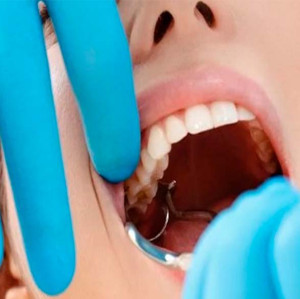 процедура удаления зуба: больно или страшно?